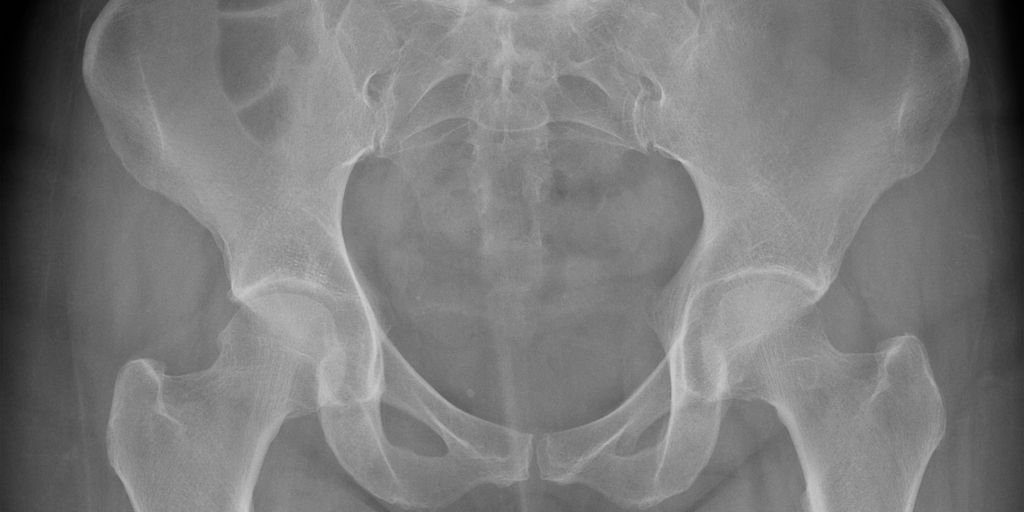 woman applying hip up cream in a modern bathroom