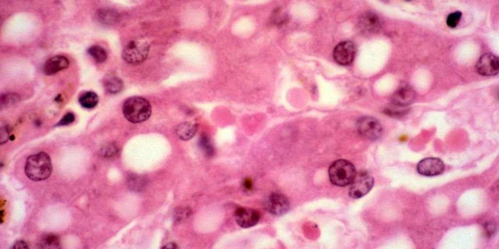 liver health supplement