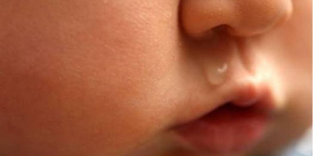 homeopathic treatment for nasal polyps